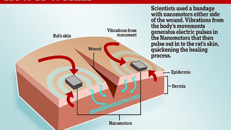 Ilmuan Kembangkan Perban Elektronik, Bisa Sembuhkan Luka 4 Kali Lebih Cepat