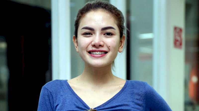 Kata Pengacara soal Nikita Mirzani Lepas Hijab
