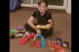 Ayah Hampar 9 Lengan Robot, Putranya yang Buntung Tersenyum