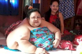 Suka Makan Gorengan dan Minum Es, Berat Badan Wanita Ini 350 Kg
