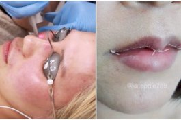 Ubah Penampilan Biar Makin Menarik, Ini Tren Operasi yang Populer di Kalangan Asia