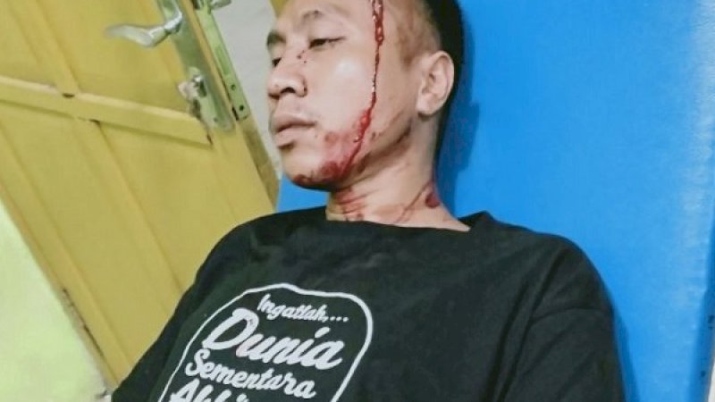 Sakti Arya Saputra (23) yang jadi korban pengeroyokan.