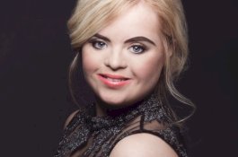 Model Down Syndrome ini Jadi Brand Ambassador Merek Kosmetik Ternama