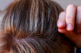 Kentang Bisa Hilangkan Uban, Begini Caranya