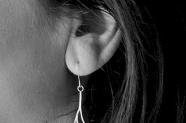 Hanya Bisa Mendengar Suara Perempuan, Apa Sih Reverse-slope Itu?