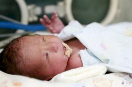 Wanita yang Lahir Tanpa Rahim dan Vagina Akhirnya Lahirkan Bayi