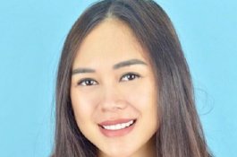 Disebut Kena HIV/AIDS, Begini Jawaban Aura Kasih