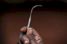 Sunat Putrinya, Wanita Ini Ditangkap Bersama Mantra, Jeruk Nipis, Lidah Sapi dan Paku