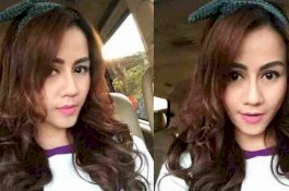 Wajah Nita Thalia Lumpuh Usai Oplas Rp1 M, Ini Penjelasan Medisnya