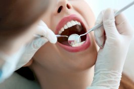 Jarang Disadari, Ini Penyebab Gigi Goyang