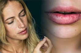 Bibir Kering? Mungkin Anda Kelebihan Vitamin Ini