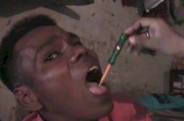 Pria ini Klaim Bisa Menahan Listrik 11.000 Volt Tanpa Tersengat