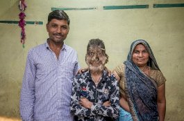 Lalit Patidar, Manusia Serigala Dalam Kehidupan Nyata