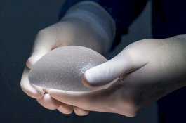 Hat-hati Implan Payudara, Bisa Picu Kanker Langka