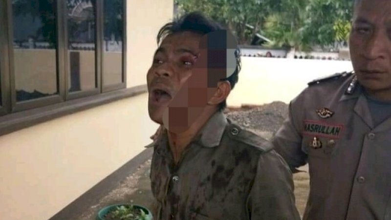 Faisal Dg Pole yang menjadi korban pengeroyokan siswa dan orang tuanya di Takalar.