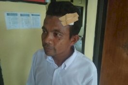 Dianiaya oleh Siswa, Daeng Pole Alami 6 Jahitan di Kepala
