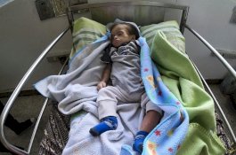 Memilukan: Begini Kondisi Anak-anak Kelaparan di Venezuela, Maduro Kekeh Tolak Bantuan