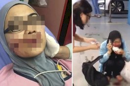 Wanita Cantik Ini Ditebas Wajahnya oleh Mantan karena Tolak Balikan