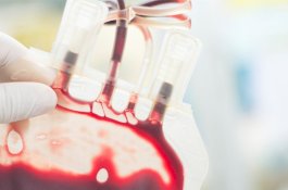 Transfusi Darah Manusia Muda Tak Bisa Cegah Penuaan