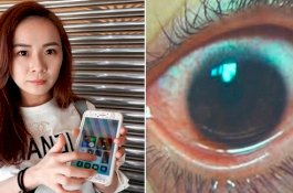 Layar Ponselnya Terlalu Terang, Kornea Mata Wanita Ini Alami 500 Lubang