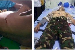 Pada Tikaman Ke-5, Tukang Jahit Sepatu Tumbang di Taman Hutan Kota