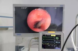 2 Bulan Batuk Darah, Pria Ini Tak Sadar Besarkan Lintah di Tenggorokan