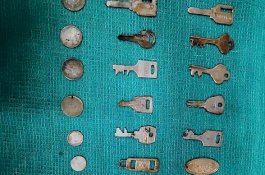 Ngeri! Dokter Keluarkan 40 Benda Logam Dalam dari Perut Pria ini