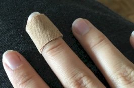 Ibu Gangguan Mental Gigit Jari Polisi Sampai Putus