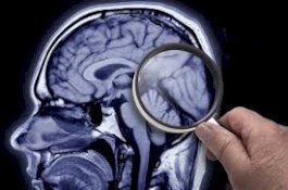 Ilmuan Temukan Cara Menghapus Memori Otak, Bisa Hapus Ingatan Soal Mantan?