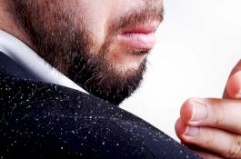 Termasuk Pola Makan, Ini Penyebab Tak Terduga Munculnya Ketombe