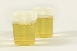 Pria Ini Minum Urin Tua untuk Atasi Penyakitnya