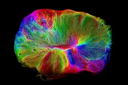 Ilmuwan Kembangkan Otak Mini untuk Membantu Pasien Stroke