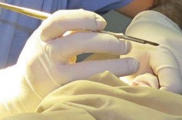 Bayi Lima Bulan Meninggal Setelah Disunat oleh Orangtuanya