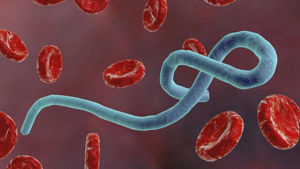Wabah Ebola Mematikan Di Kongo Telah Melampaui 1.000 Kasus