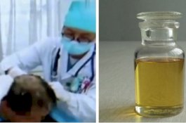 Pria Ini Kejang-kejang Usai Keramas dengan Pestisida