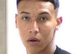 Gadis 13 Tahun Berjuang untuk Hidup Setelah Dibakar oleh Mantan Pacarnya