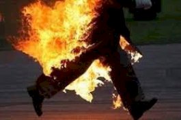 Gara-gara Minta Putus, Gadis 13 Tahun Ini Malah Dibakar Pacarnya