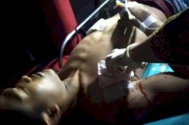 Datang untuk Berdamai, Pemuda Bone Justru Disambut dengan Tikaman Badik