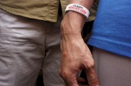 Setelah Jokowi dan Prabowo, Giliran Tangan Sandiaga Uno Luka-Luka Bekas Cengkeram