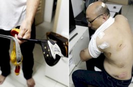 Selalu Telat Pulang, Pria Ini Dipukul Istri Pakai Stik Golf