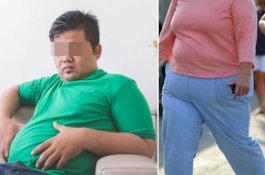 Hasil Penelitian: Semakin Besar Perut Semakin Kecil Otak