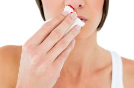 Mimisan: Penyebab, Gejala dan Cara Menghentikannya