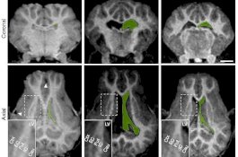 Peneliti Bisa Hidupkan Kembali Otak Babi Empat Jam Setelah Mati