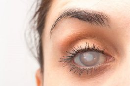 Ayo Daftar, Ada Operasi Katarak Gratis di RSUD Andi Makkasau