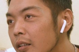 Tak Sadar Telan Earbud, Pria Ini Heran Ada Suara Musik dari Perutnya
