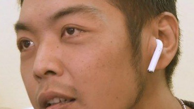 Tak Sadar Telan Earbud, Pria Ini Heran Ada Suara Musik dari Perutnya