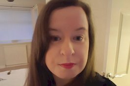 Penyakit Langka, Wanita ini Bisa Pingsan Jika Cium Aroma Jeruk