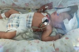 Bayi Baru Lahir Ditemukan Tertutup Lalat di Selokan, Ajaibnya Berhasil Bertahan Hidup