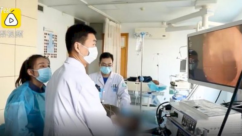 Cekcok dengan Keluarga, Wanita Ini Telan Kalung Emas 40 Cm