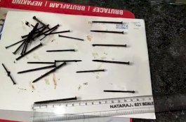 Dokter Keluarkan 116 Paku dari Perut Pria Ini